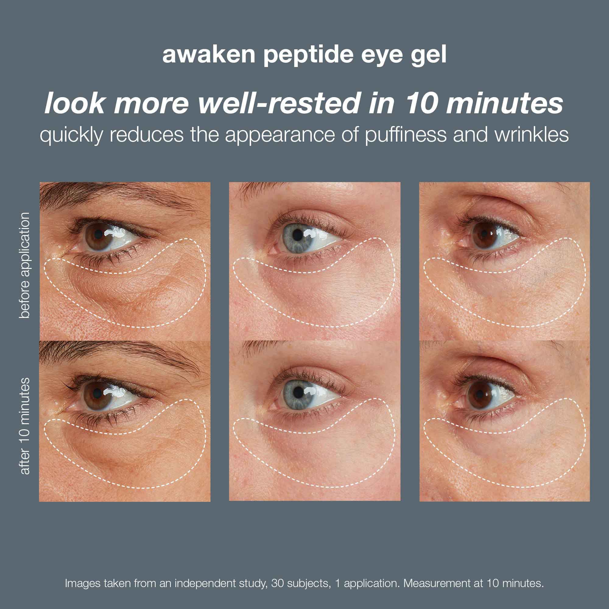 Dermalogica awaken peptide depuffing eye gel